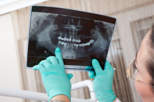 Dentist with x-ray.