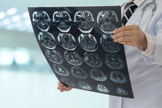 A doctor examines results of MRI. Stroke science.